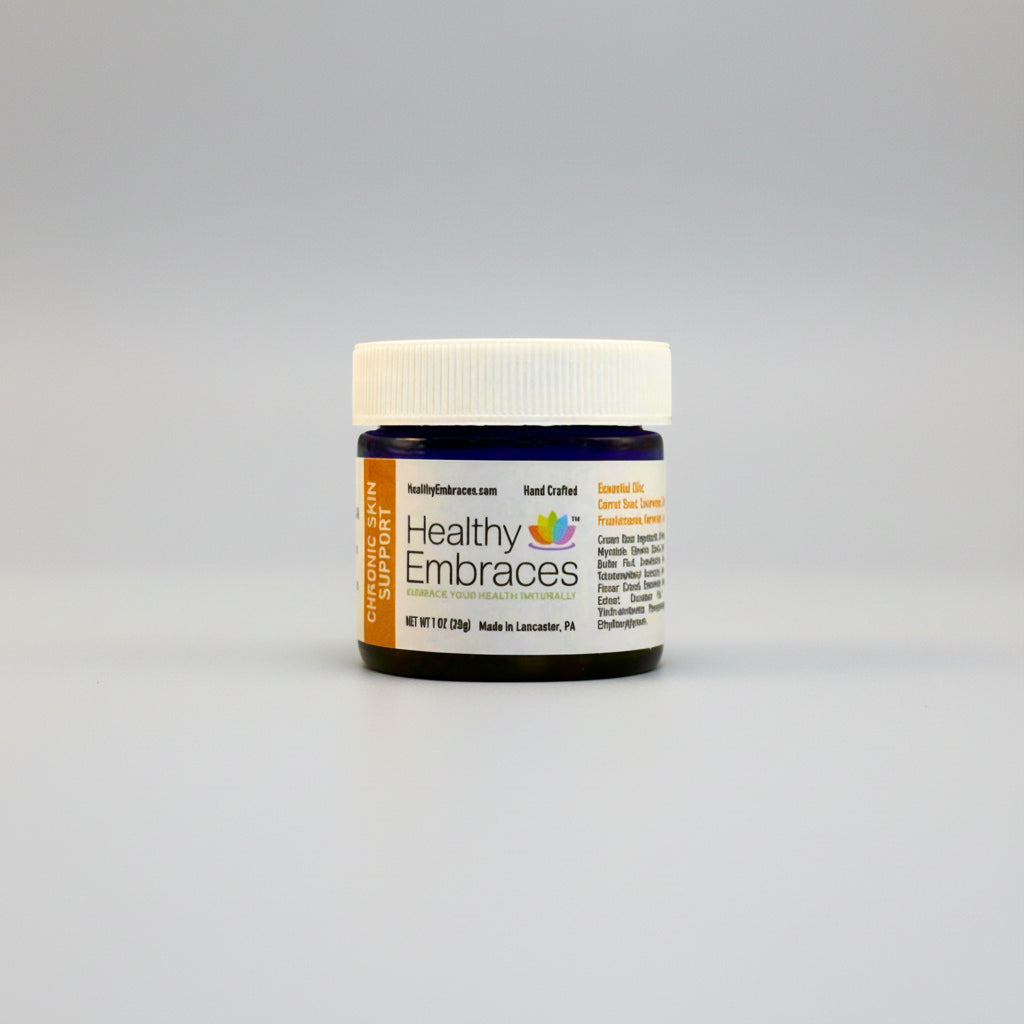 Chronic Skin Support Cream - Healthy Embraces