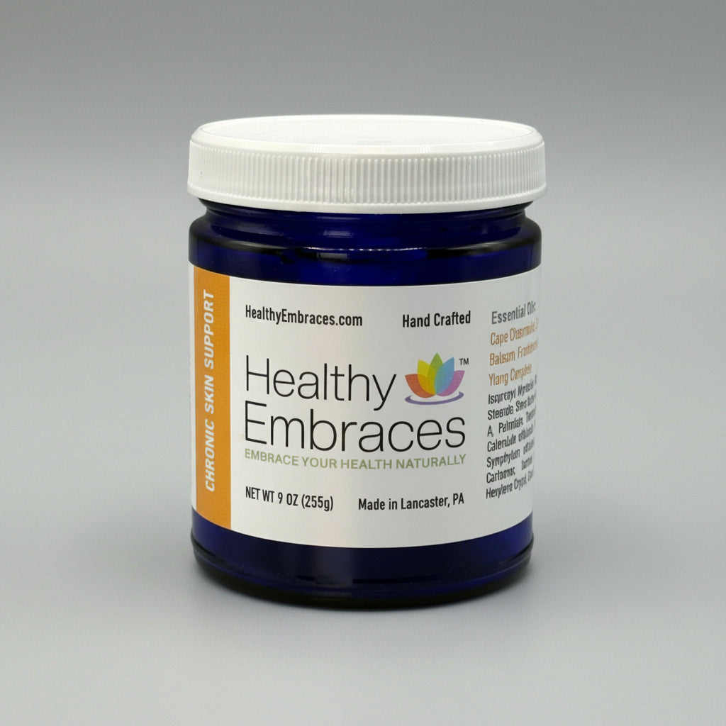 Chronic Skin Support Cream - Healthy Embraces